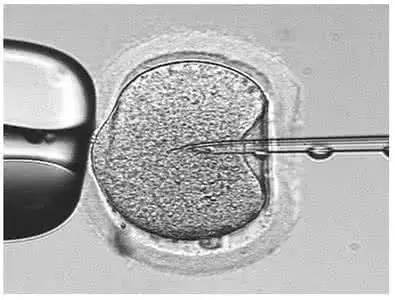 采用单精子卵胞浆显微注射做试管顺利生产