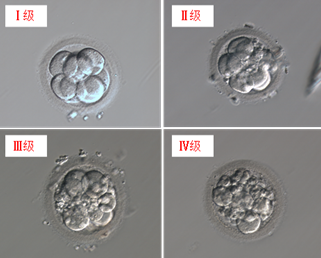 试管婴儿胚胎一共有多少等级